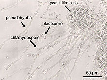 mage result for candida albicans wikipedia